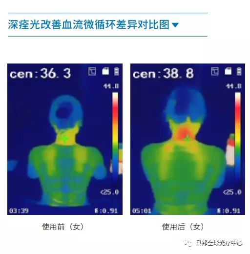 颈椎亚健康有多要命？很危险！(图7)