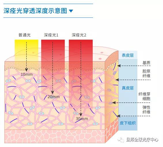 震惊中外的“深痊光”，黑科技脐光宝光疗仪发布！(图5)